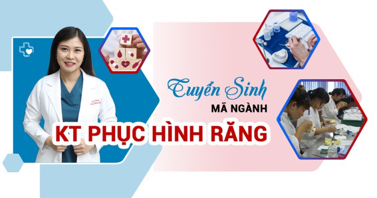 Nganh ky thuat phuc hinh rang